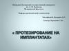 Протезирование на имплантатах