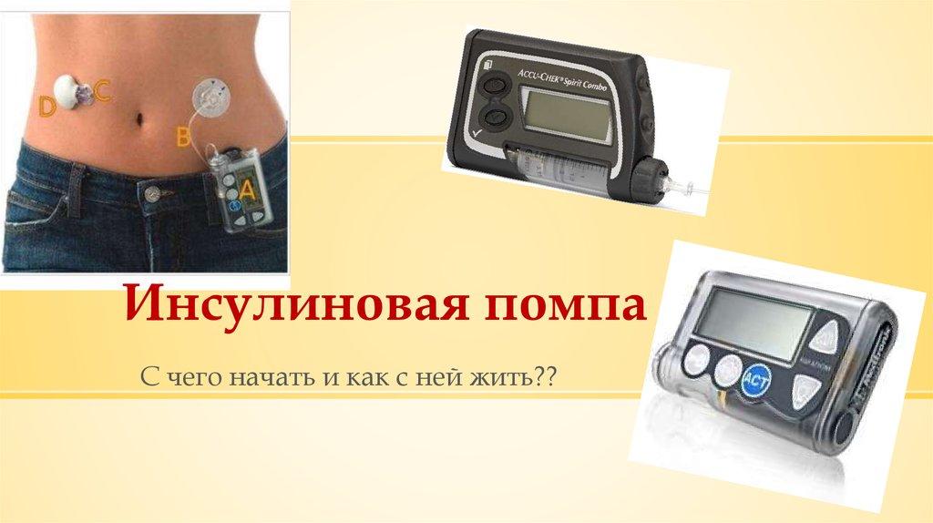 Инсулиновая помпа