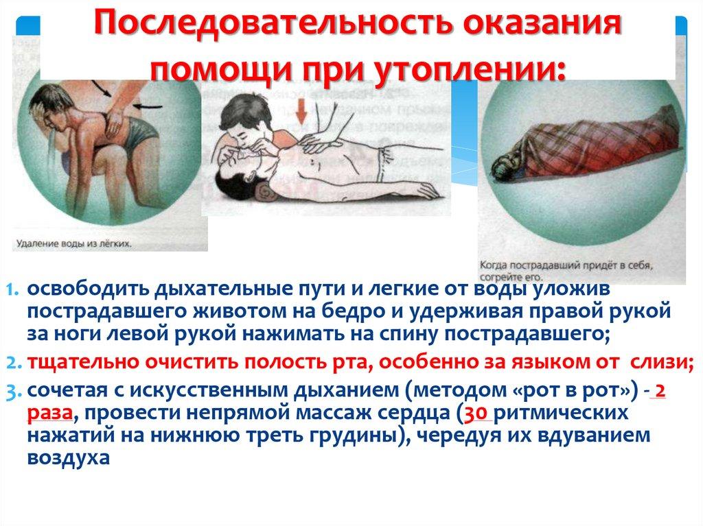 Последовательность оказания помощи при утоплении: