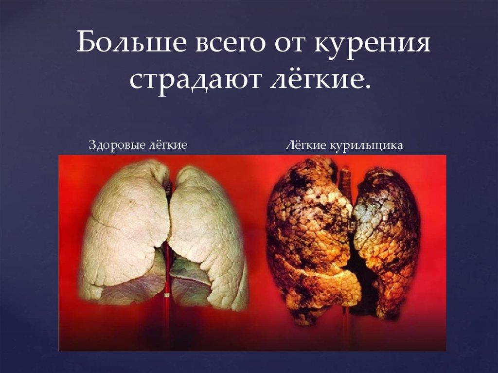 Больше всего от курения страдают лёгкие. 